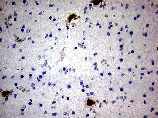 S100A9 Antibody in Immunohistochemistry (Paraffin) (IHC (P))