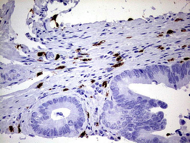 S100A9 Antibody in Immunohistochemistry (Paraffin) (IHC (P))