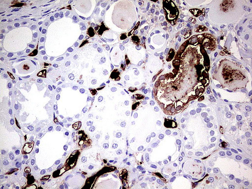 S100A9 Antibody in Immunohistochemistry (Paraffin) (IHC (P))