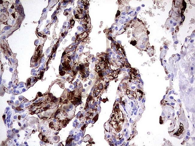 S100A9 Antibody in Immunohistochemistry (Paraffin) (IHC (P))