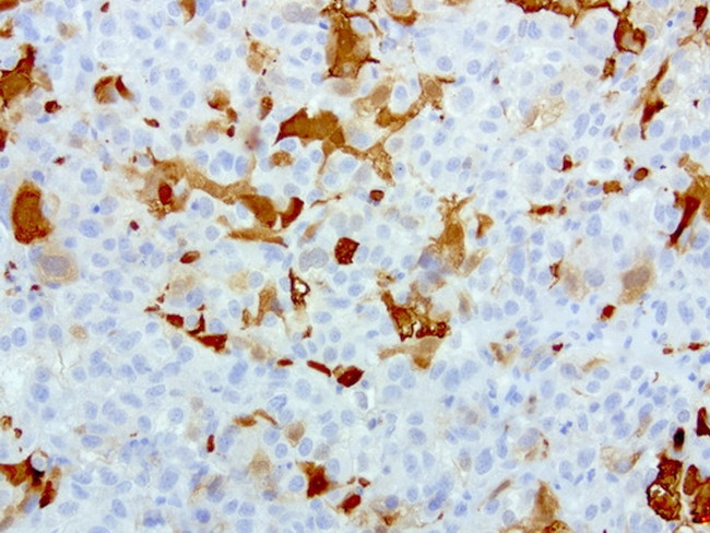 S100A9 Antibody in Immunohistochemistry (Paraffin) (IHC (P))