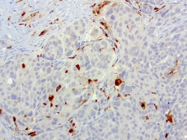 S100A9 Antibody in Immunohistochemistry (Paraffin) (IHC (P))