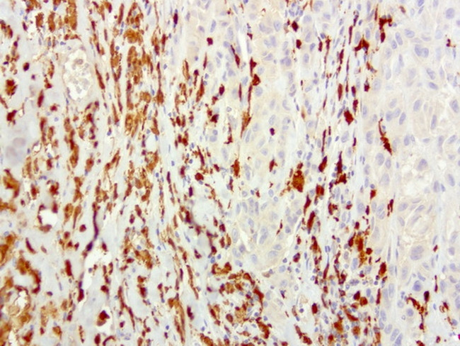 S100A9 Antibody in Immunohistochemistry (Paraffin) (IHC (P))