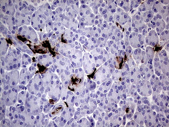 S100A9 Antibody in Immunohistochemistry (Paraffin) (IHC (P))