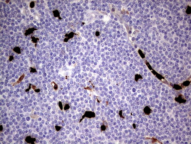 S100A9 Antibody in Immunohistochemistry (Paraffin) (IHC (P))