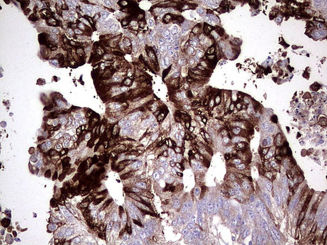 S100A9 Antibody in Immunohistochemistry (Paraffin) (IHC (P))