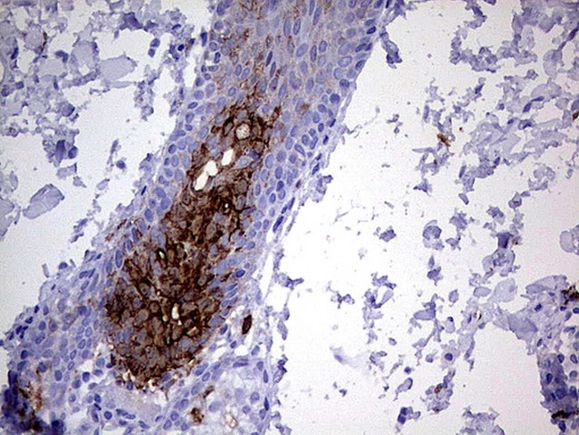 S100A9 Antibody in Immunohistochemistry (Paraffin) (IHC (P))