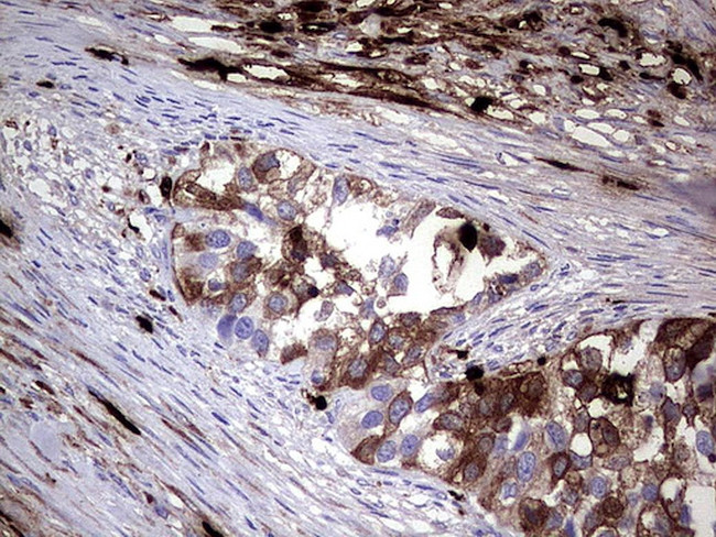 S100A9 Antibody in Immunohistochemistry (Paraffin) (IHC (P))