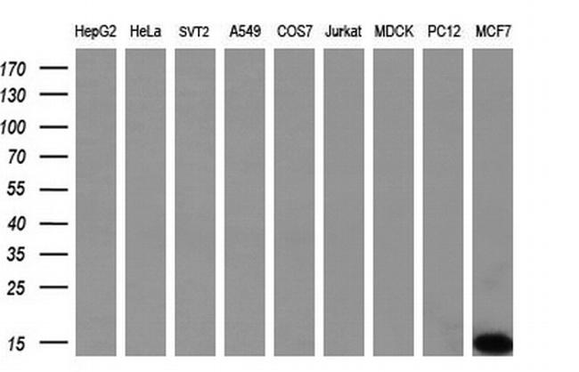 S100A9 Antibody in Western Blot (WB)