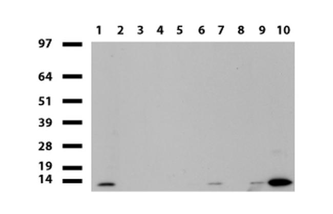 S100A9 Antibody in Western Blot (WB)