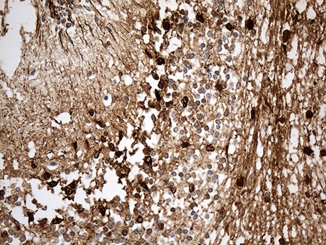 S100B Antibody in Immunohistochemistry (Paraffin) (IHC (P))