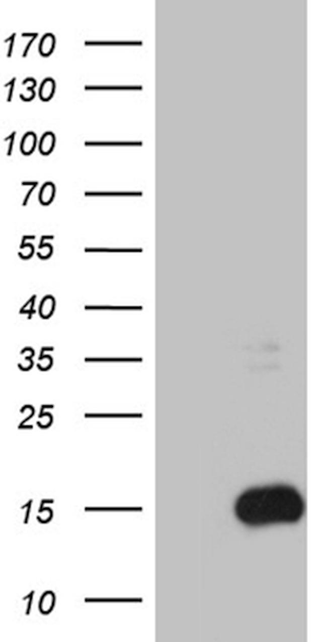 S100B Antibody in Western Blot (WB)