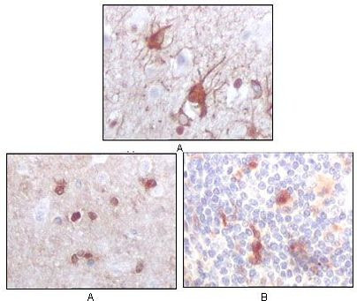 S100B Antibody in Immunohistochemistry (Paraffin) (IHC (P))