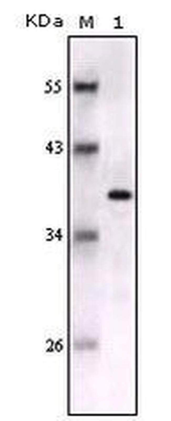 S100B Antibody in Western Blot (WB)