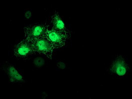 S100P Antibody in Immunocytochemistry (ICC/IF)