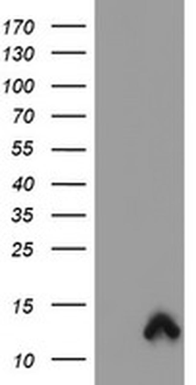 S100P Antibody in Western Blot (WB)