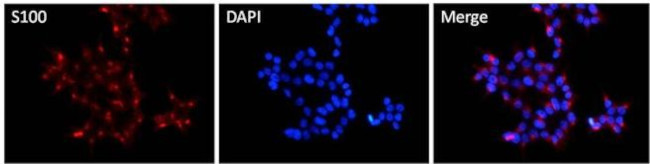 S100A1 Antibody in Immunocytochemistry (ICC/IF)