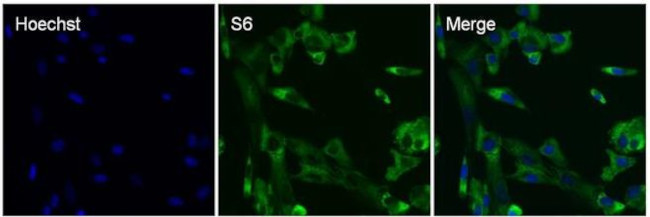 S6 Antibody in Immunocytochemistry (ICC/IF)