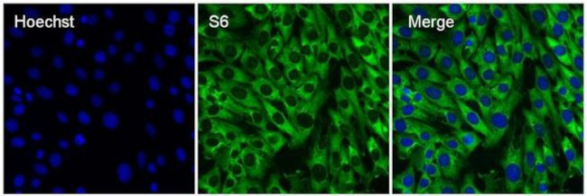 S6 Antibody in Immunocytochemistry (ICC/IF)