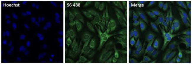 S6 Antibody in Immunocytochemistry (ICC/IF)