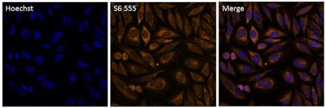 S6 Antibody in Immunocytochemistry (ICC/IF)