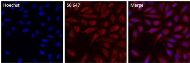 S6 Antibody in Immunocytochemistry (ICC/IF)