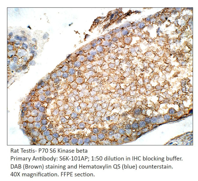 P70 S6 Kinase beta Antibody in Immunohistochemistry (IHC)