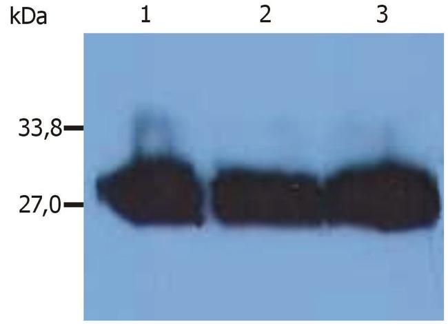 Human Kappa Light Chain Secondary Antibody in Western Blot (WB)