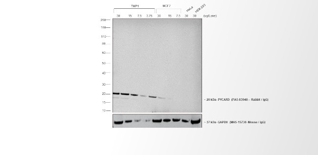 Rabbit IgG (H+L) Cross-Adsorbed Secondary Antibody in Western Blot (WB)