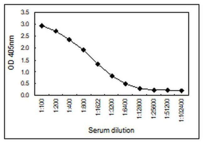 Human IgM Secondary Antibody in ELISA (ELISA)