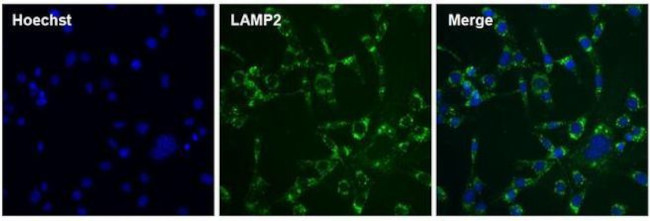 Rat IgG (H+L) Cross-Adsorbed Secondary Antibody in Immunocytochemistry (ICC/IF)