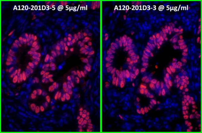 Rabbit IgG (H+L) Cross-Adsorbed Secondary Antibody in Immunohistochemistry (Paraffin) (IHC (P))