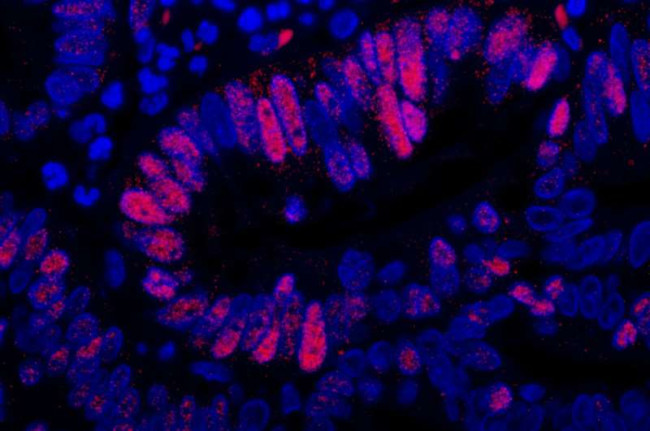 Goat IgG (H+L) Cross-Adsorbed Secondary Antibody in Immunohistochemistry (Paraffin) (IHC (P))