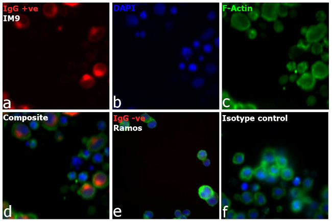 Human IgG (H+L) Cross-Adsorbed Secondary Antibody in Immunocytochemistry (ICC/IF)