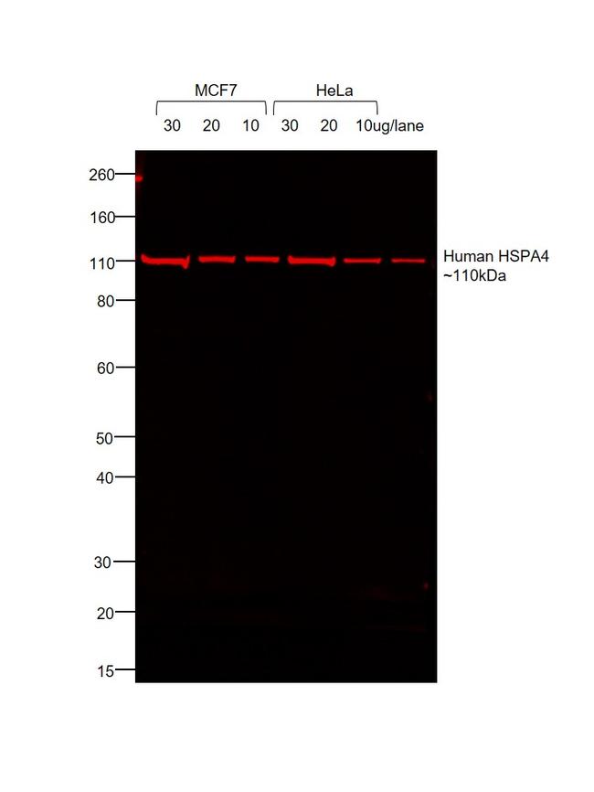 Human IgG (H+L) Cross-Adsorbed Secondary Antibody in Western Blot (WB)