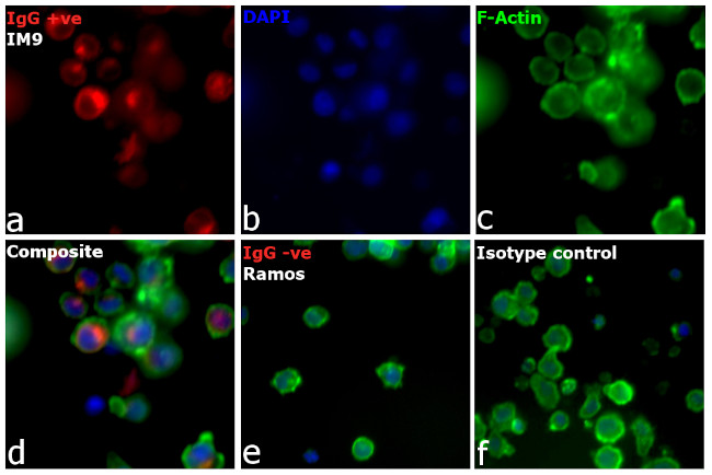 Human IgG (H+L) Cross-Adsorbed Secondary Antibody in Immunocytochemistry (ICC/IF)