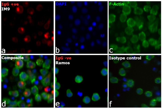 Human IgG Fc Cross-Adsorbed Secondary Antibody in Immunocytochemistry (ICC/IF)