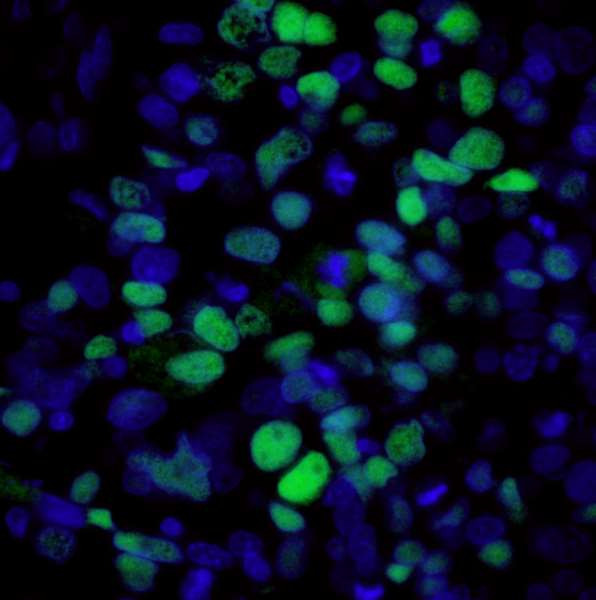 Mouse IgG (H+L) Cross-Adsorbed Secondary Antibody in Immunohistochemistry (Paraffin) (IHC (P))