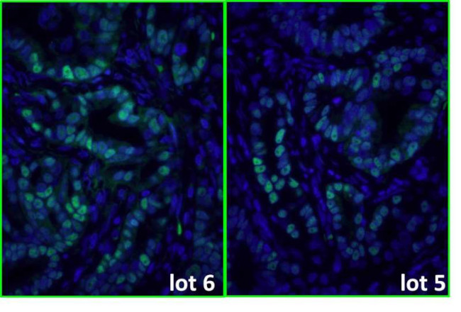 Mouse IgG (H+L) Cross-Adsorbed Secondary Antibody in Immunohistochemistry (Paraffin) (IHC (P))