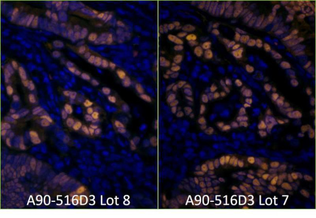 Mouse IgG (H+L) Cross-Adsorbed Secondary Antibody in Immunohistochemistry (Paraffin) (IHC (P))