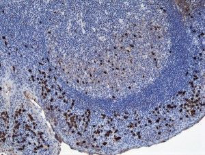 Human IgA1 Secondary Antibody in Immunohistochemistry (IHC)