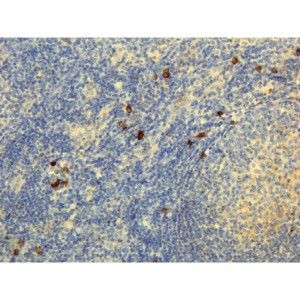 Human IgG4 Secondary Antibody in Immunohistochemistry (IHC)