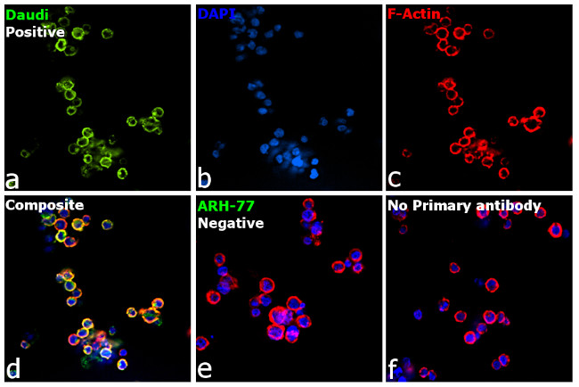 Human IgM Secondary Antibody in Immunocytochemistry (ICC/IF)