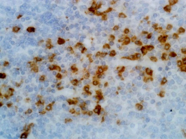 Human Kappa Light Chain Secondary Antibody in Immunohistochemistry (IHC)