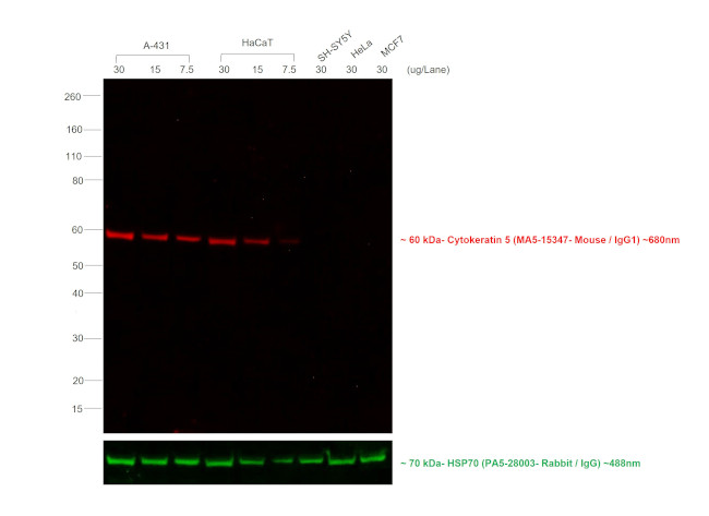 Mouse IgG (H+L) Secondary Antibody in Western Blot (WB)