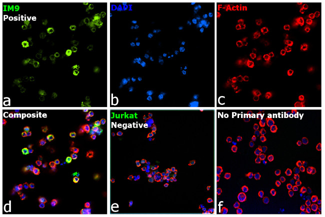 Human IgG (Heavy chain) Secondary Antibody in Immunocytochemistry (ICC/IF)