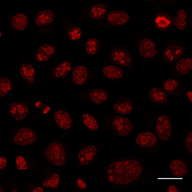 Rabbit IgG Nano (VHH) Secondary Antibody in Immunocytochemistry (ICC/IF)