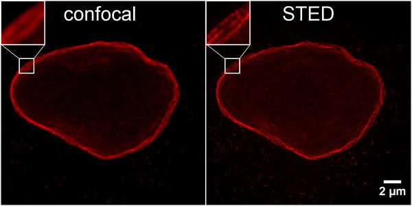 Rabbit IgG Nano (VHH) Secondary Antibody in Immunocytochemistry (ICC/IF)