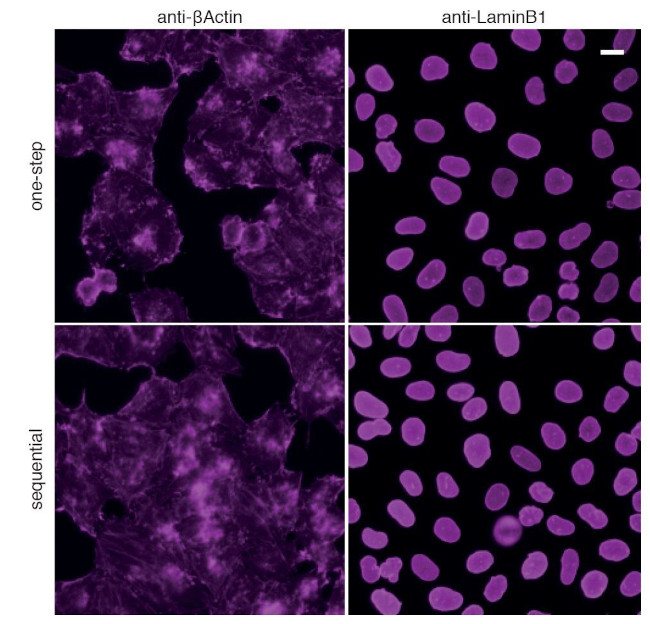 Rabbit IgG Nano (VHH) Secondary Antibody in Immunocytochemistry (ICC/IF)