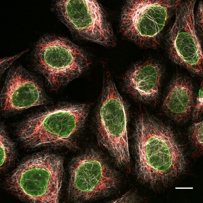 Mouse IgG1 Nano (VHH) Secondary Antibody in Immunocytochemistry (ICC/IF)